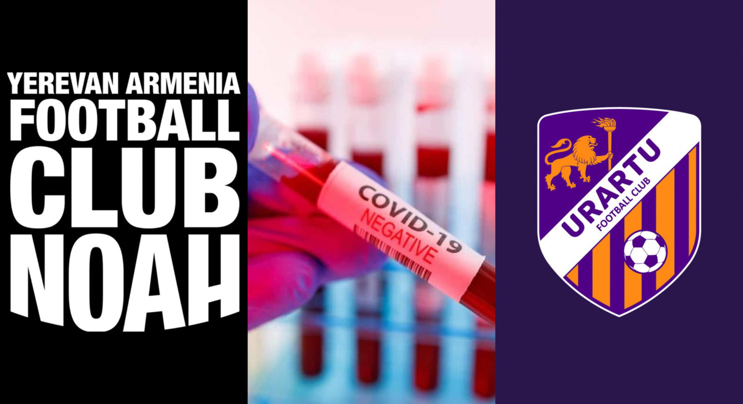 ՀՀ բարձրագույն խմբի մի շարք ակումբների ֆուտբոլիստներ COVID-19-ի թեստավորում են անցել