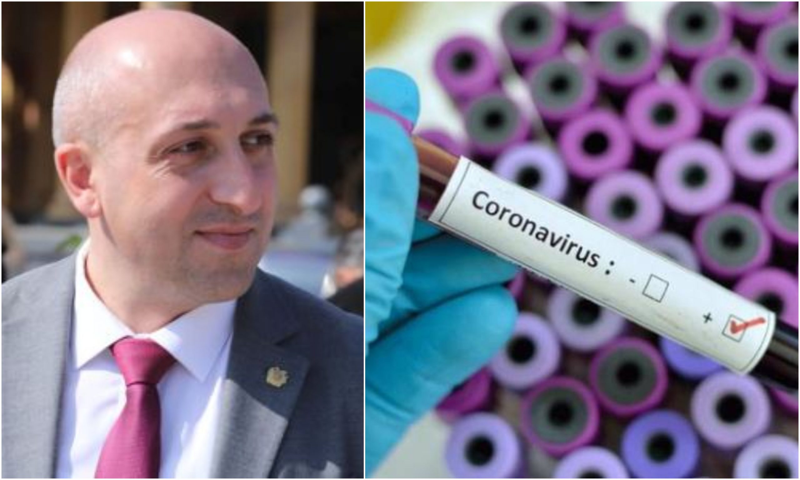 Լոռու մարզում կա կորոնավիրուսով վարակվածության 3 դեպք․ Լոռու մարզպետ