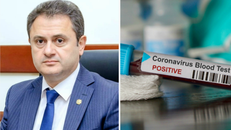 Տավուշի մարզում գրանցվել է կորոնավիրուսային հիվանդության հաստատված 5 դեպք