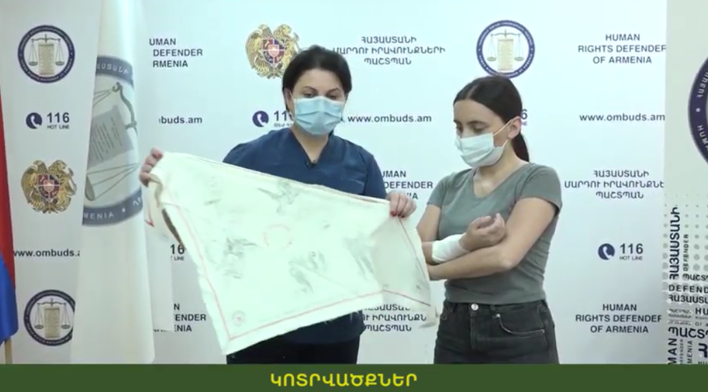Ինչպե՞ս առաջին օգնություն ցույց տալ կոտրվածքների դեպքում. իրազեկող տեսանյութ