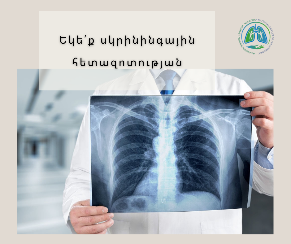 Թոքաբանության ազգային կենտրոնը երևանցիների համար կազմակերպում է անվճար ֆլյուորոգրաֆիկ սքրինինգային հետազոտություններ