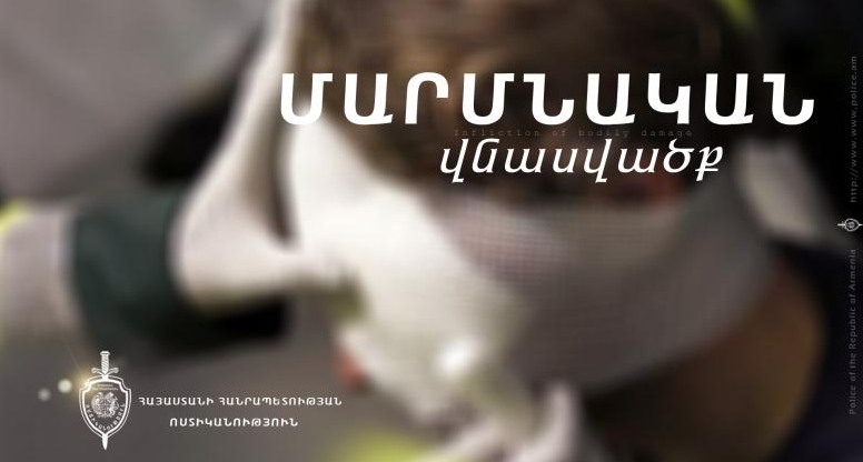 Մարմնական վնասվածքներ պատճառած տղամարդիկ հայտնաբերվել են. ոստիկանների բացահայտումը