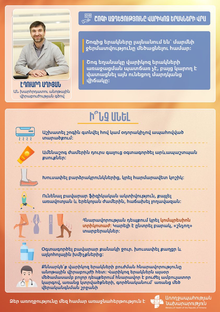 Ինչ ազդեցություն ունի շոգը վարիկոզ երակների վրա