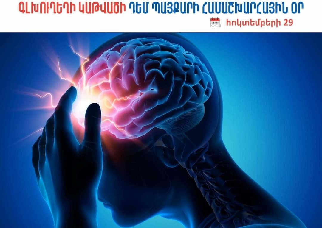 Գլխուղեղի կաթվածի հիմնական ախտանիշներն ու բուժման հնարավորությունները ՀՀ-ում