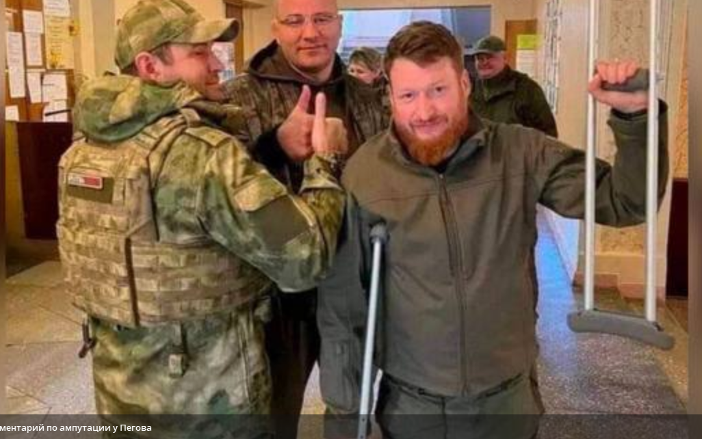 Սեմյոն Պեգովի ոտքն անդամահատել են