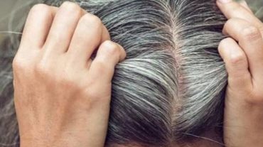 Մասնագետը նշում է երիտասարդ տարիքում ալեհեր մազերի առաջացման պատճառները