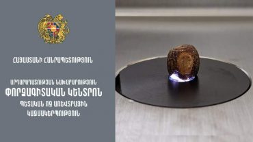 Փորձագիտական կենտրոնում այսուհետ կիրականացվի իր տեսակի մեջ եզակի հետազոտություն՝ մարդու օրգանիզմում գոյացող երիկամային և լեղապարկային քարերի փորձաքննություն