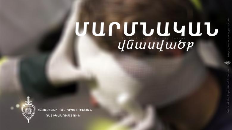 16-ամյա պատանին բահով խփել էր 43-ամյա համագյուղացու գլխին