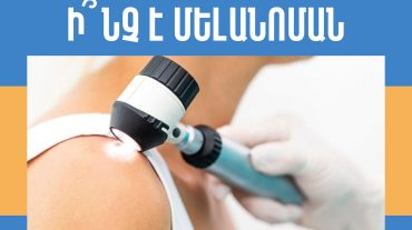 Մաշկի քաղցկեղի և մելանոմայի իրազեկման ամսվա շրջանակներում Այրվածքաբանության և մաշկաբանության ազգային կենտրոնում տեղի կունենա անվճար խորհրդատվություն