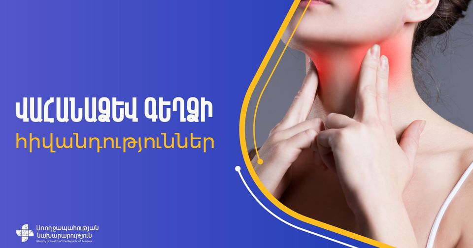 Վահանաձև գեղձի հիվանդությունների մեծ մասը սթրեսի հետևանք է. ԱՆ