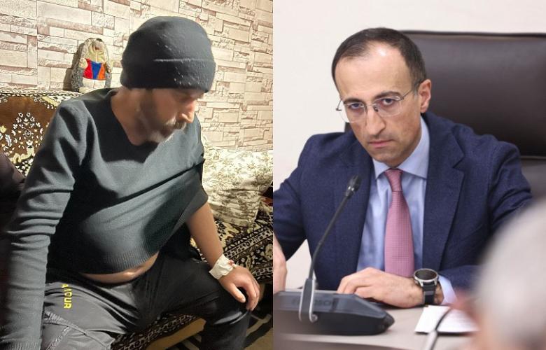 Կապի մեջ ենք Օհանի հարազատների հետ, կփորձենք աջակցել բուժման իրականացմանը. Արսեն Թորոսյան